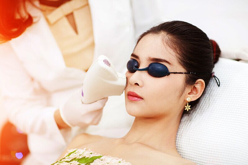 Laser Rejuvenatioun
