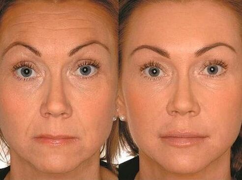Virun an no der Mikrocurrent Therapie